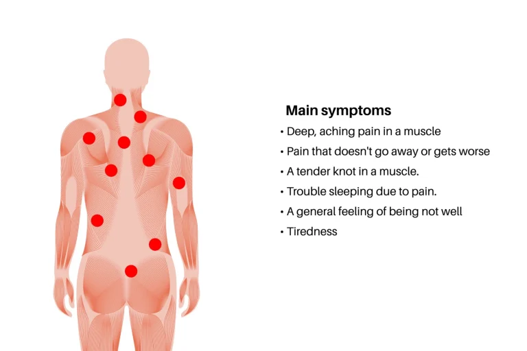 Trigger Point Injections Trigger Point Injections