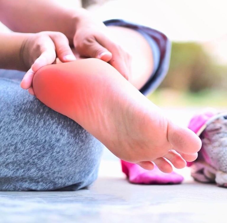 Living with Plantar Fasciitis